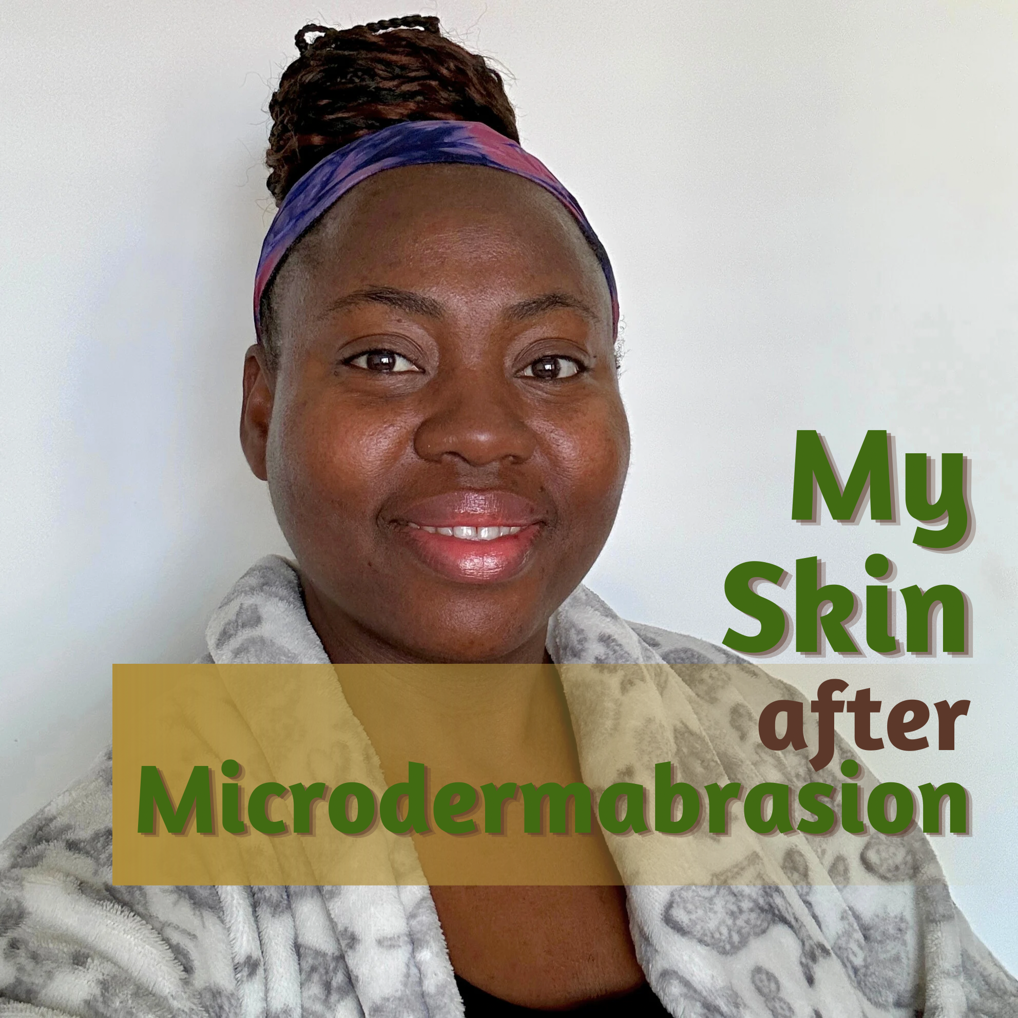Unveiling the Magic of Microdermabrasion: Your Guide to Smoother, Brighter Skin