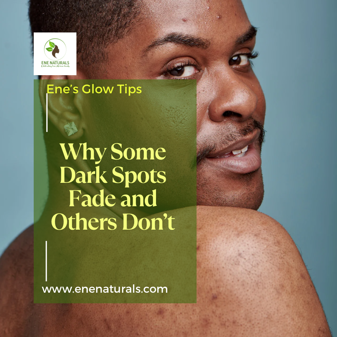 Why Some Dark Spots Fade and Others Don’t